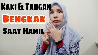 Tips Atasi Kaki Bengkak Saat Hamil