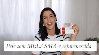 FLEBON - Como eliminei o MELASMA e ganhei uma pele perfeita | MULHERES ATUAIS