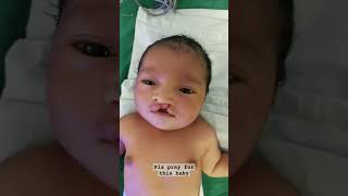 viral short #new born baby# celft lip baby #plzz watch my vidoe and subrcribe#