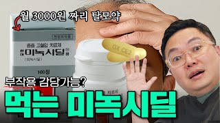 먹는 미녹시딜에 대한 질문이 왜 이렇게 많지?!ㅣ미녹시딜 정 Q&A