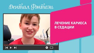 👩‍⚕️ Лечение кариеса в седации