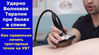 Фокусная Ударно Волновая Терапия Триггерных Точек