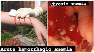 HEMORRHAGIC ANEMIA  in hindi | tarang academy