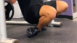 i snapped my ankle squatting... (graphic)