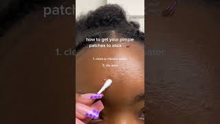 How to get your pimple patches to stick #skincare #hygiene #skincaretips