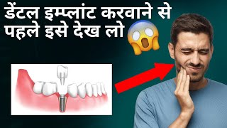 Are dental implants painful? | क्या डेंटल इंप्लांट लगवाने में दर्द होता है?