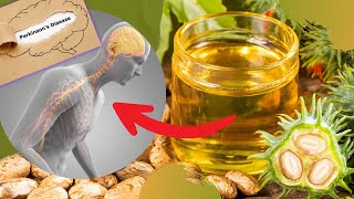 Castor Oil - 23 Castor Oil Home Remedies for Health and Beauty