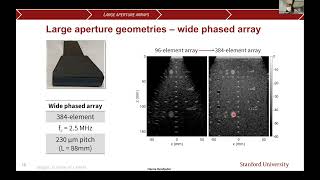 Stanford Radiology: PHIND (Winter) 2022, Bendjador: Theragnostic 3D ultrasound imaging system