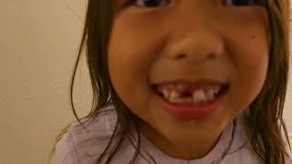 Olivia lost her 3rd Tooth by Accident