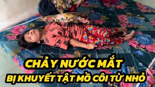 Thiếu Nữ Xinh Đẹp Bị Khuyết Tật Mồ Côi Cha Mẹ Khiến Dân Làng Ai Nấy Cũng Xót Xa