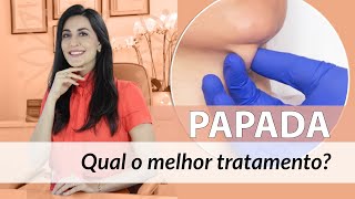 Papada - como escolher o melhor tratamento para diminuir a papada no pescoço?