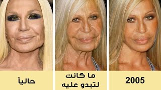 كيف سيبدو 8 مشاهير إذا لم يخضعوا لإجراءات التجميل الحديثة مطلقاً لن تصدق كيف ستكون😱