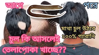 টাক পোকা রোগ হলে 100% কাজ হবে, মাথা গোঁফ বা দাড়িতে নতুন চুল হবে | এই জিনিসের প্রমাণ হলো আমি | part 2