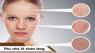 Làm thế nào để thu nhỏ lỗ chân lông ?