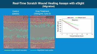 Real-Time Scratch Wound Healing Assays with eSight