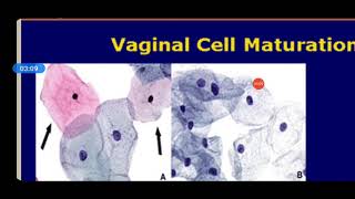 Cytohormonal study of vaginal Epithelium