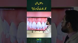 Daanton Mein Terhe Pan Ki Wajah KYa? | Health Matters #crookedteeth #treatment #dentist