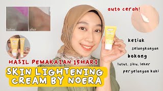 REVIEW JUJUR NOERA SKIN LIGHTENING CREAM UNTUK MENCERAHKAN KETIAK, SLENGKI, LUTUT, SIKU