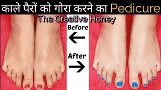 Feet whitening pedcure at home/ how to remove sun tan/remove cracked heels