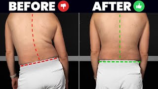 Fix Lateral Pelvic Tilt FOR GOOD