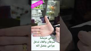 تشافي مريضة سرطان والغاء تدخل جراحي بفضل الله ثم منتجاتنا للاستفسار تواصل معنا واتساب 00393664459013