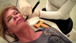 Pelleve Skin Tightening at Jardin Medical Spa in Philadelphia