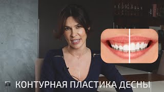 КОНТУРНАЯ ПЛАСТИКА ДЕСНЫ | ДЛЯ ЧЕГО И КОМУ НУЖНА