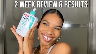 CeraVe Foaming Facial Cleanser Review | Is it worth the hype?