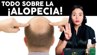 ¿COMO EVITAR LA CAIDA DEL CABELLO? TODO SOBRE LA ALOPECIA!