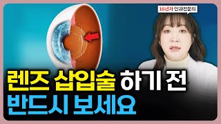 렌즈삽입술? 라식 라섹? 수술 전에 무조건 봐야 하는 영상(#안과전문의)