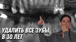 Ошибка стоматолога. Почему девушка потеряет все зубы в 30 лет. Как мы это исправляем?