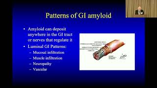 ATTR  Amyloidosis & the Gut: GI Symptoms & Treatments