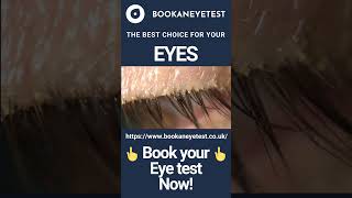 Crust on Eyelids | Why Do My Eyes Feel Like They Have A Crust? | Book an eye test | Blepharitis