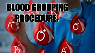 HOW TO PERFORM BLOOD GROUPING. PROCEDURE AND RESULT INTERPRETATION.