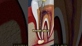 Episode 72: Root Canals, Wisdom Teeth, and Biological Dentistry ft. Dr. Dominik Nishwitz