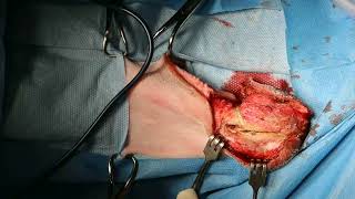 Rostral mandibulectomy in a dog