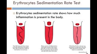 4-Erythrocytes sedimentation rate TEST