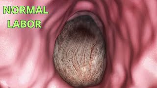 Amazing Normal Labor 🤱 Vaginal Birth.