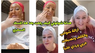 المسك السحري لكيعلاج الكلف البقع السوداء وحتي تصبغات اقسم بالله الا لوجه كيولي صافي وابيض بحال اطفال