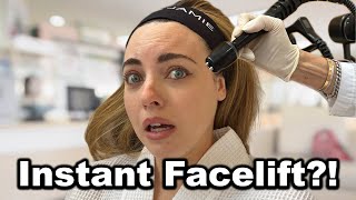 No Surgery Facelift Treatment?!