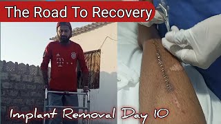 Implant Removal Day 10 || Tibia Fibula Fracture Recovery || The Road To Recovery