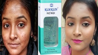 Best Face Wash for Oily Skin|Best Face Wash For Acne Prone Skin|Part 3