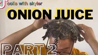 Onion Juice Challange | Part 2