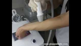 Ultraslim II-cavitation review-liposuction cavitation slimming machine-buy cavitation machine