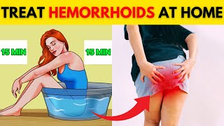 How To Treat Hemorrhoids | 7 Natural Treatments (Plant Flavonoids) for Hemorrhoidal Disease