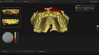 * IDDA MiniBytes - How to design a SPLINT with Inlab 22 with STL's from ANY scanner *