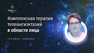 Комплексная терапия телеангиэктазий в области лица с применением IPL и Nd:YAG лазера