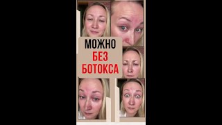 Можно без ботокса