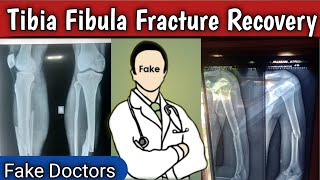 Fake Doctors||Tibia Fibula Fracture Recovery,doctron ki galti aise doctron se bachna chahiye?