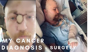 My Rare Cancer Diagnosis Story - Part 2 My Surgery